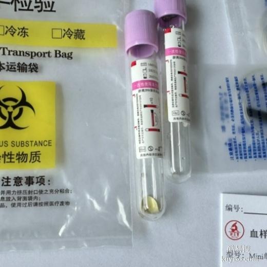 金華便宜的親子鑒定方法-2025更新鑒定指南