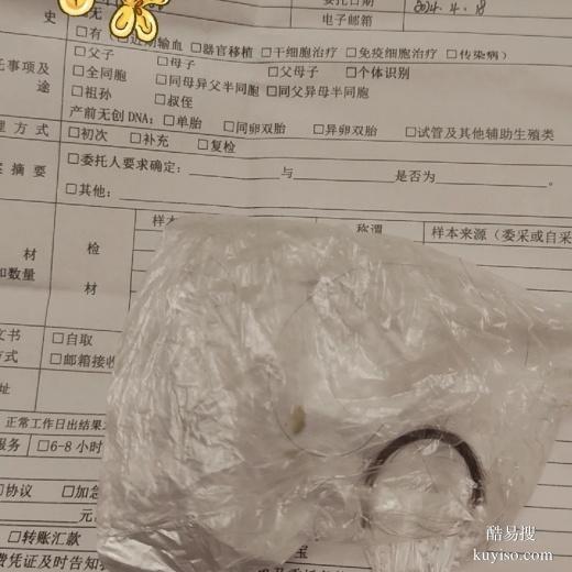 邵陽悄悄做親子鑒定怎么做親子檢驗醫(yī)院地址醫(yī)院地址在哪里